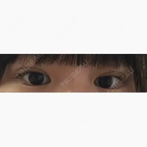 小倉美容外科ネビュラクリニック口コミ
