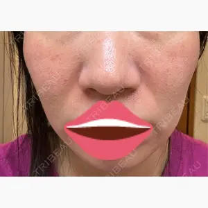 DAILY SKIN CLINIC 新宿院口コミ
