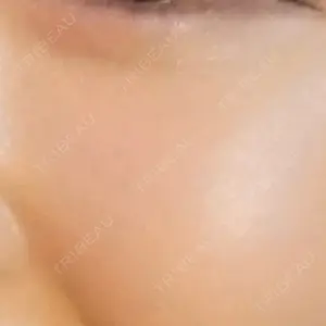 HAAB CLINIC 池袋院口コミ