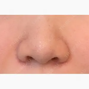 聖心美容クリニック 六本木院口コミ