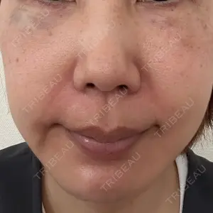 TCB東京中央美容外科 宇都宮院口コミ