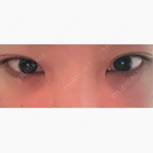 アリエル美容クリニック 水戸院口コミ