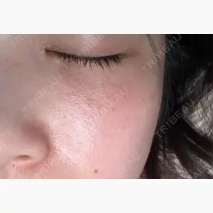 やさしい美容皮膚科・皮フ科　東京浅草院口コミ