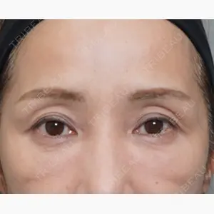 アリエル美容クリニック 大宮院口コミ