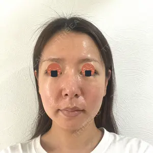 聖心美容クリニック 六本木院口コミ