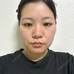 アリエル美容クリニック 水戸院口コミ