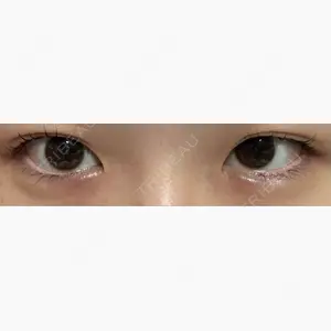 あいちビューティークリニック栄本院口コミ