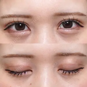 アリエル美容クリニック 大宮院口コミ