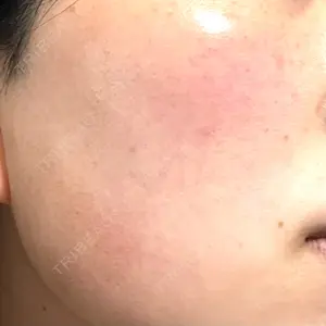 ルラ美容クリニック 神戸院口コミ