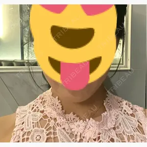 LiLAスキンクリニック中目黒口コミ