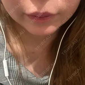 ルラ美容クリニック 神戸院口コミ