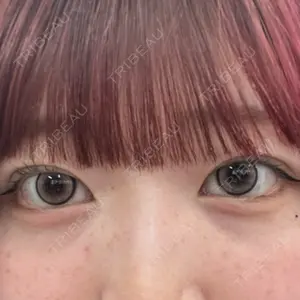 アリエル美容クリニック 郡山院口コミ