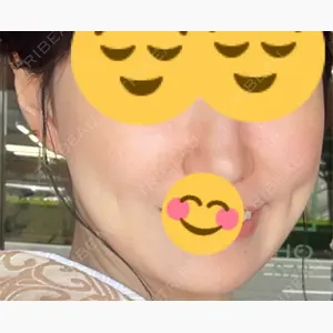 ルラ美容クリニック 京都院口コミ