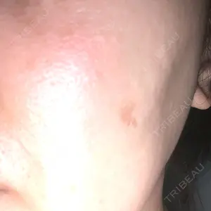 ルラ美容クリニック銀座院口コミ