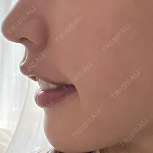 EMMO FACE CLINIC 東京三田院口コミ