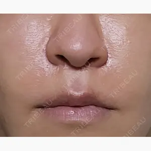 聖心美容クリニック 六本木院口コミ
