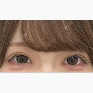 Brandnew Beauty Clinic口コミ