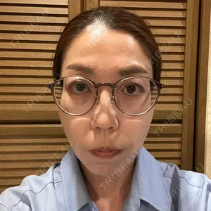 ノエル銀座クリニック口コミ