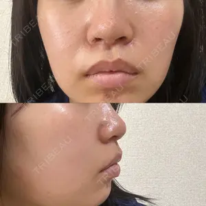広島本通り美容クリニック口コミ