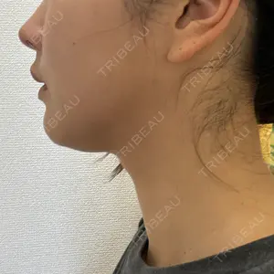 ヴェリテクリニック 大阪院口コミ