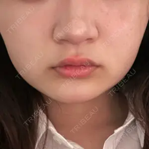 A CLINIC（エークリニック） 池袋院口コミ
