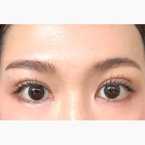 HAAB×DREAM BEAUTY CLINIC 東京本院口コミ
