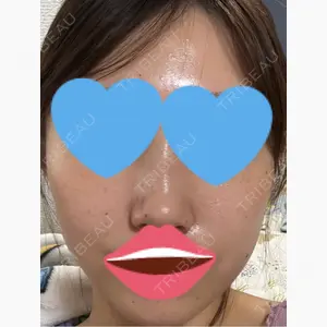ケセラクリニック口コミ