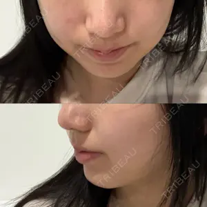 湘南美容クリニック 渋谷院口コミ