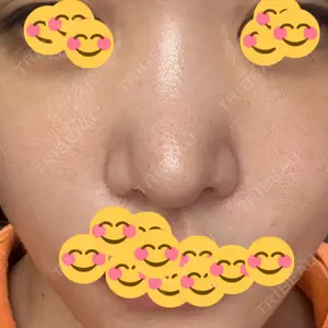 Zetith Beauty Clinic 福岡院口コミ
