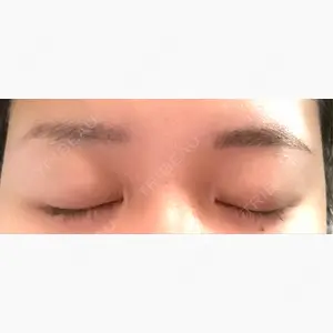 NARU Beauty Clinic 【ナルクリ】 水戸院口コミ