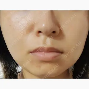 ルラ美容クリニック 宇都宮院口コミ