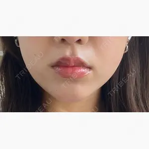 momo beauty  clinic口コミ