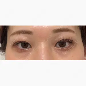 Brandnew Beauty Clinic口コミ