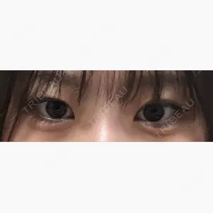 BITO BEAUTY CLINIC口コミ
