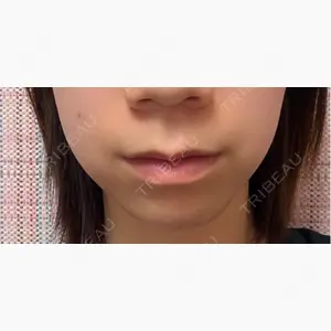 共立美容外科 神戸三宮院口コミ