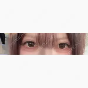 いちのせ形成外科・皮膚科 眼瞼＆フェイスクリニック口コミ