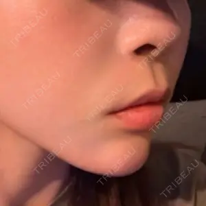 PRISM Beauty Clinic 町田院口コミ