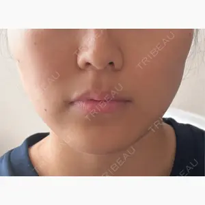 FACE SKIN CLINIC 池袋口コミ
