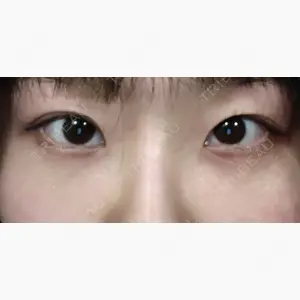 NARU Beauty Clinic 【ナルクリ】口コミ