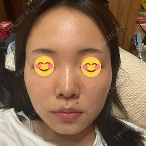 TCB東京中央美容外科 藤沢院口コミ