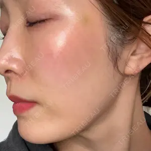 椿クリニック 名古屋院口コミ