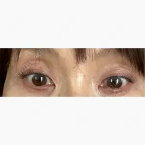 ルラ美容クリニック 郡山院口コミ
