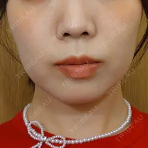 LUHO（ルホ）美容外科口コミ