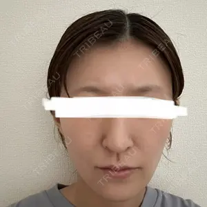 アリエル美容クリニック 大宮院口コミ
