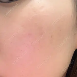 椿クリニック 名古屋院口コミ