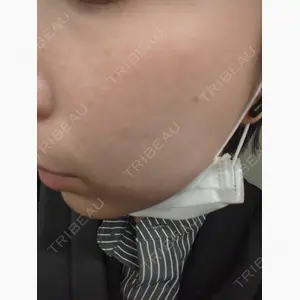 L‘amour clinic Tokyo【ラムールクリニック東京】口コミ