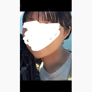 東京BELLEZZAクリニック口コミ