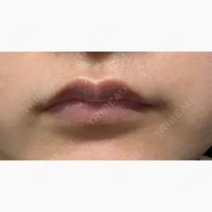 東京ココセランクリニック口コミ