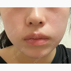 Leap beauty clinic口コミ