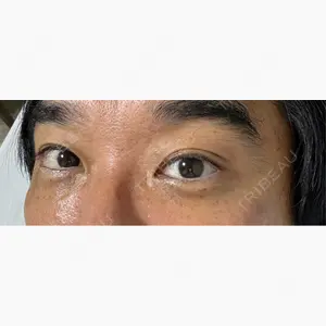 東京シンデレラ美容外科 大宮院口コミ